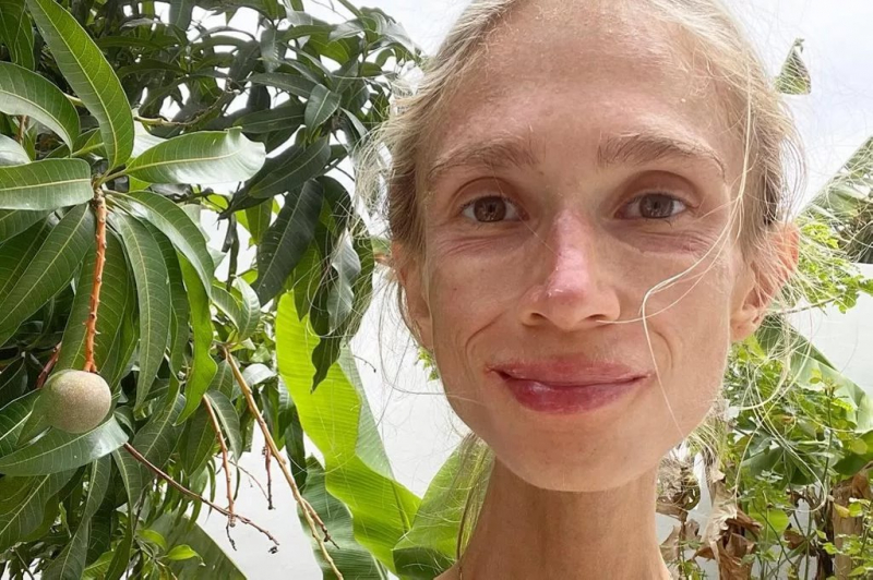 Умерла девушка, питавшаяся только фруктами — она весила чуть больше 20 кг Умерла девушка, питавшаяся только фруктами — она весила чуть больше 20 кг